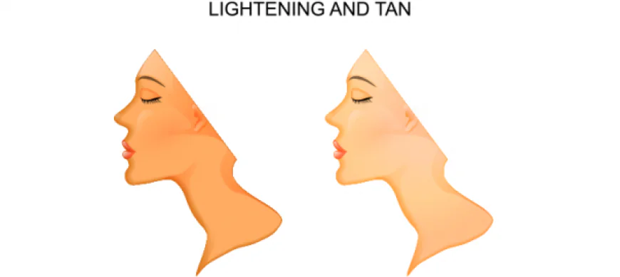 How to Lighten Skin Tone Safely with Expert Skin Care