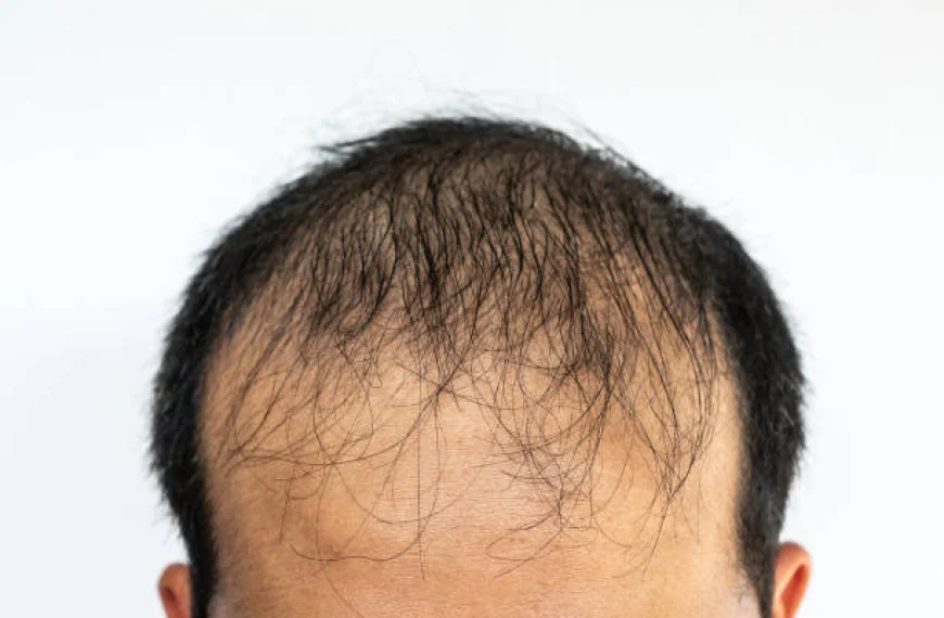 Can GFC Treatment for Hair Strengthen Hair?