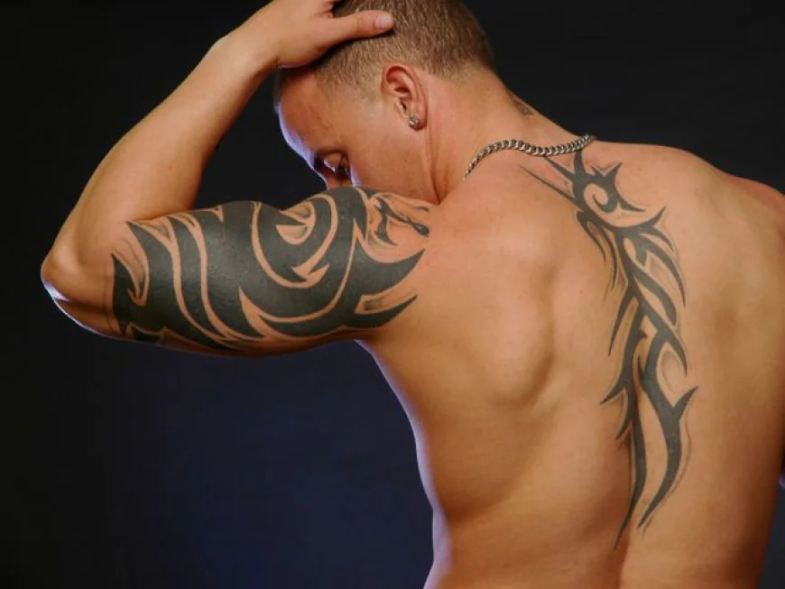 Can PicoSure Laser Tattoo Removal Treat Color Ink?