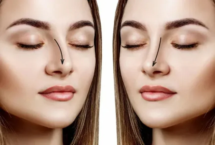 Rhinoplasty in Dubai: Custom Approaches for Unique Faces