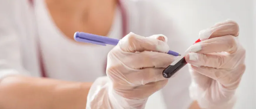 Why Regular AIDS HIV Testing Is Essential for Early Detection and Better Health
