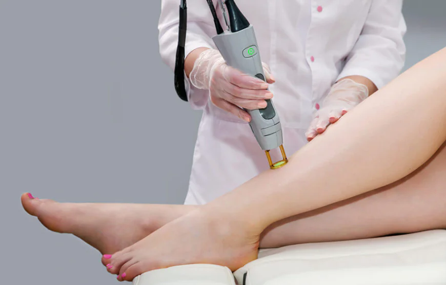 Benefits of Choosing Professional Laser Hair Removal Surrey