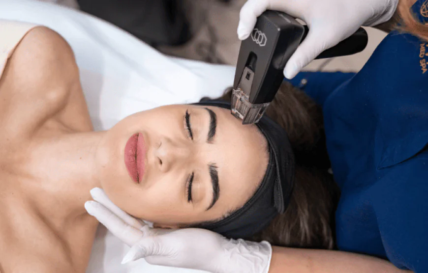Can Morpheus8 Help Bring Back Your Skin’s Radiance?