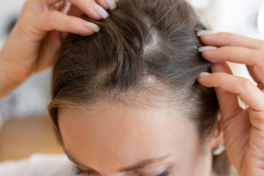 Is PRP treatment effective for hair loss concerns