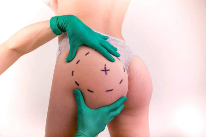 How Does Brazilian Butt Lift Surgery Work