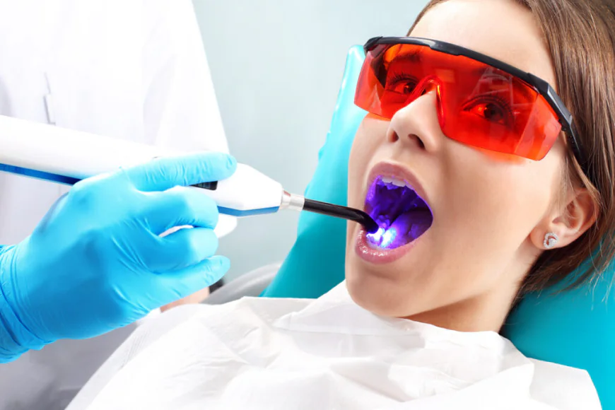 What Are Dental Sealants and How Do They Prevent Cavities?