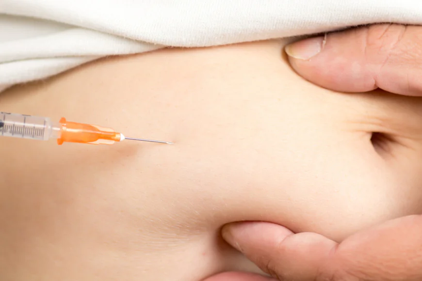 Can Fat Melting Injections Refine Body Proportions?