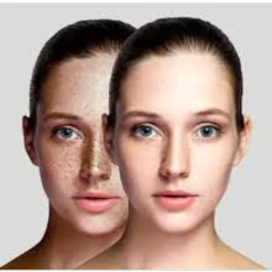 Your Pigmentation Isn't Stubborn — You're Just Treating It Wrong