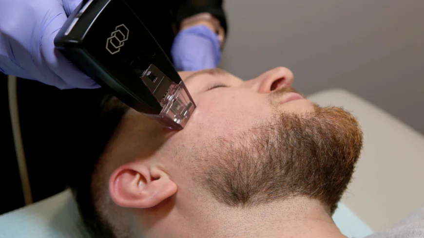 Is Morpheus8 Therapy Suitable for Every Skin Type?