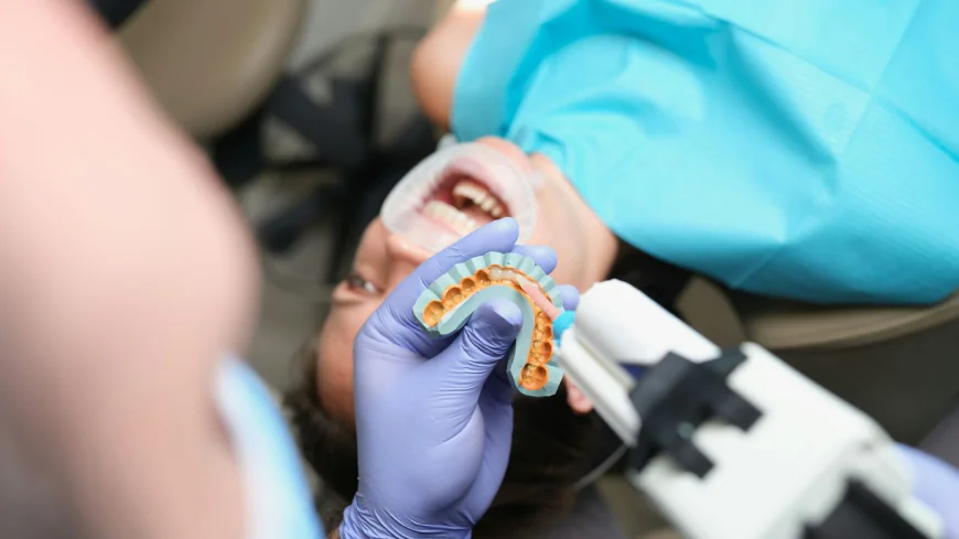 How to Choose the Best Dental Veneers in Dubai
