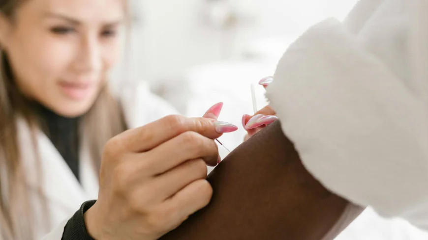 Microneedling Acupuncture vs. Traditional Microneedling