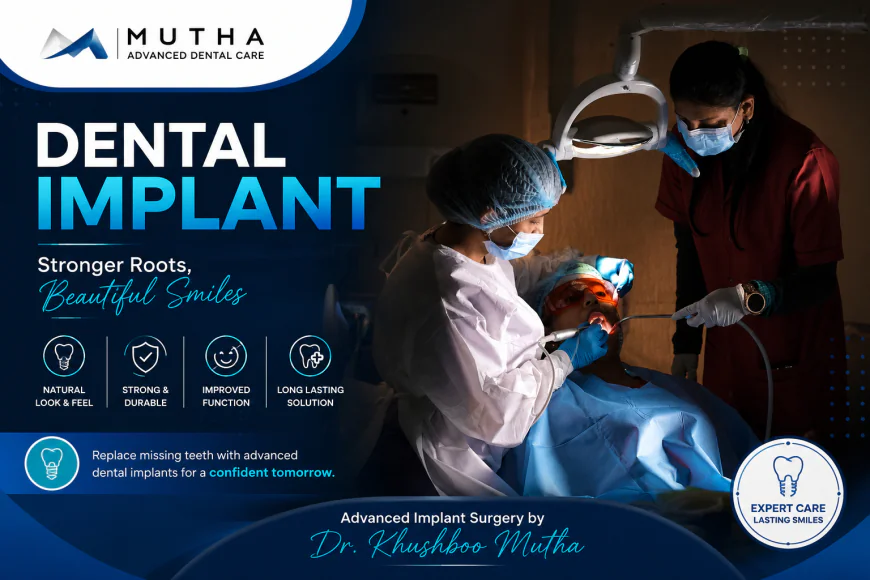 Dental Implant: How the Procedure Works Step by Step