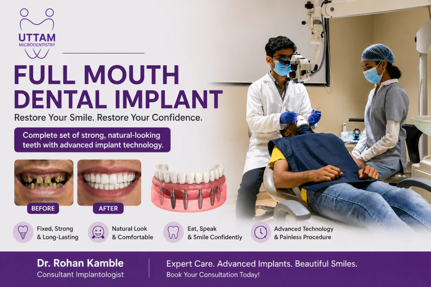 Full Mouth Dental Implants Cost: A Complete Guide for Patients