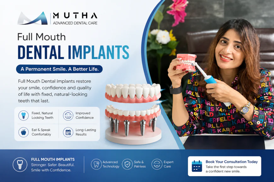 Full Mouth Dental Implants Cost: 7 Factors That Influence Your Treatment Plan