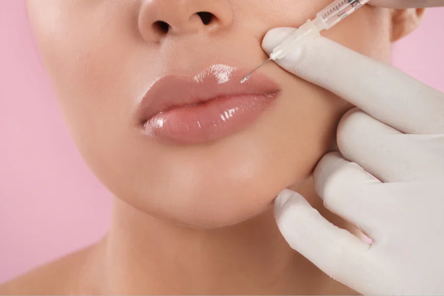 How Can Lip Fillers Injections Enhance Your Smile?