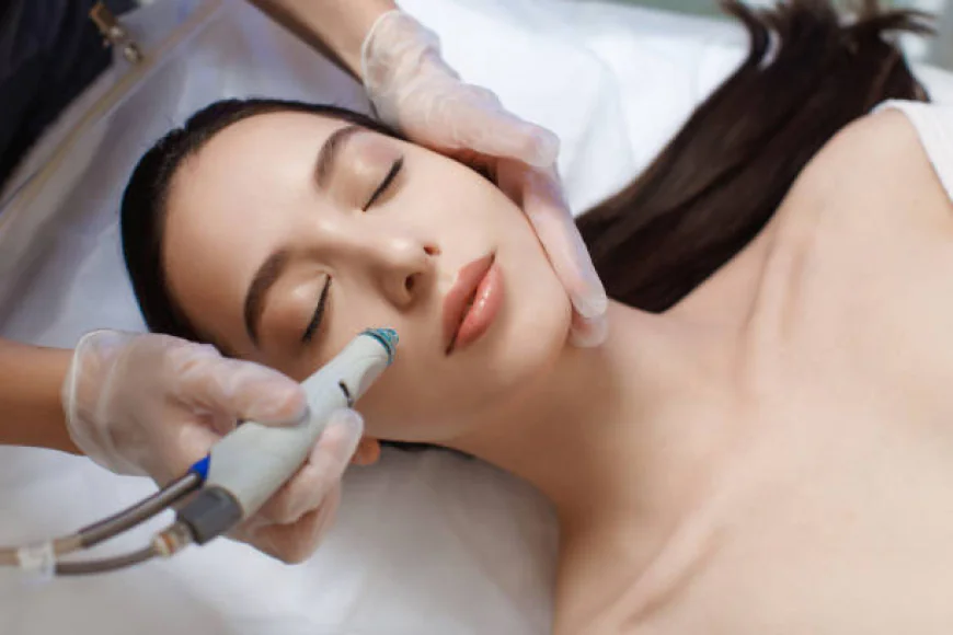 Does HydraFacial Help with Mild Acne Scars?