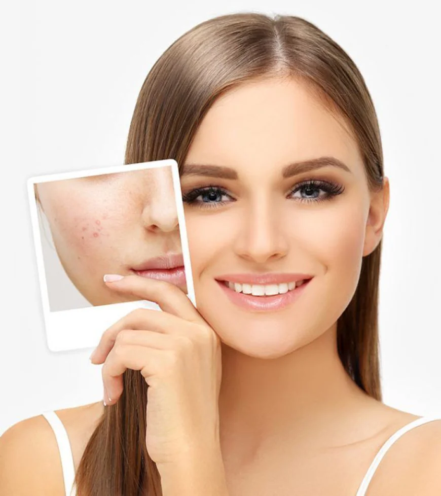Laser Scar Removal in Dubai: Modern Skin