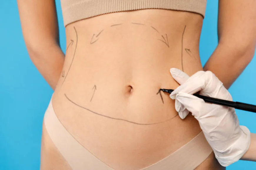 Can Mini Tummy Tuck Tighten Abdominal Muscles?