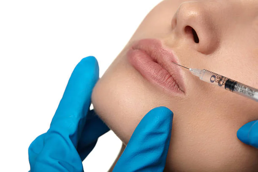 Can Russian Lip Fillers Boost Confidence?