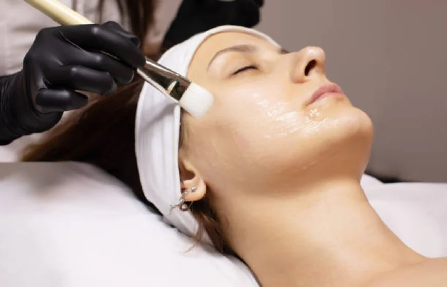 Does Inno Peel reduce acne scars effectively