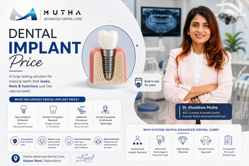 Teeth Implants Price: What You Should Know Before Choosing Dental Implants