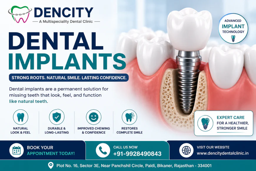 Dental Implant Specialist: Why Expertise Matters for a Healthy and Confident Smile