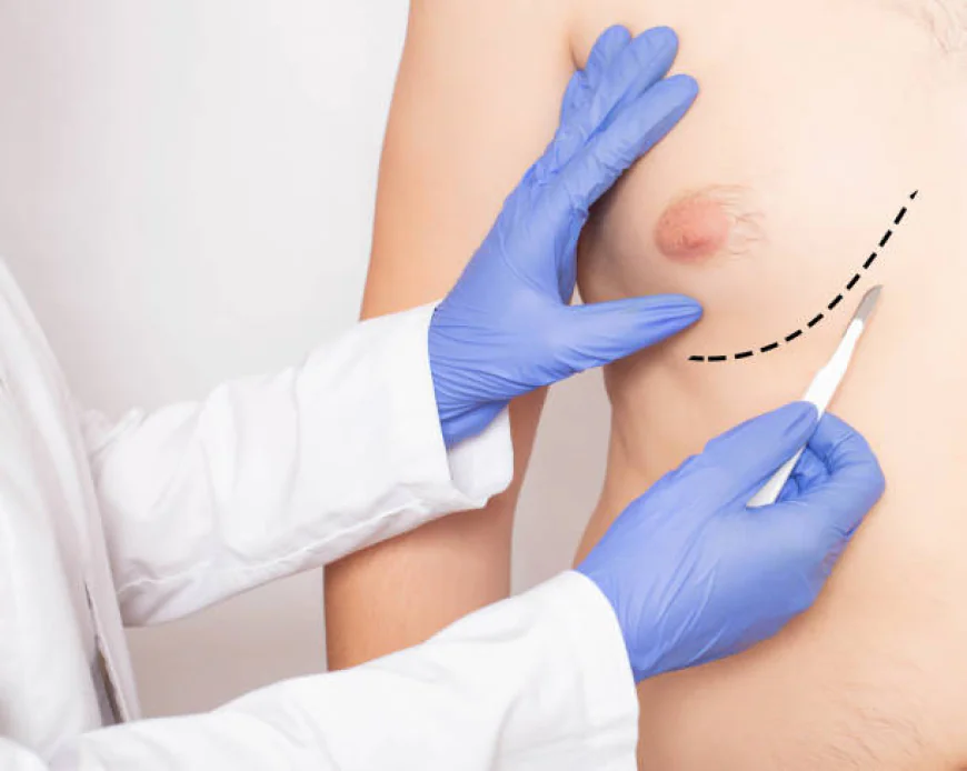 Is Gynecomastia Surgery suitable for young men