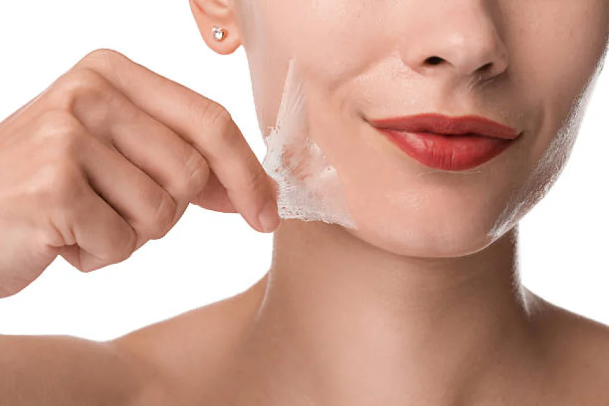 Does Chemical Peel Help Fade Dark Spot Marks?