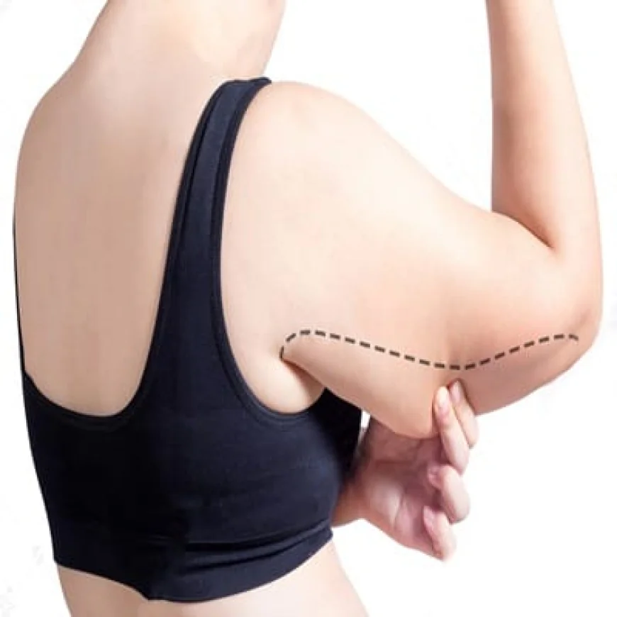 Is Arm Lift Surgery Appropriate for Older Adults?