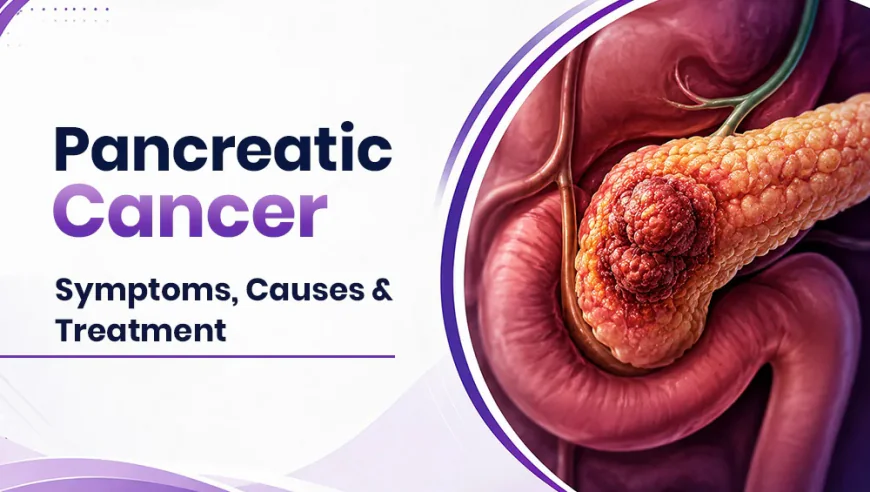 Pancreatic Cancer: Symptoms, Causes & Treatment