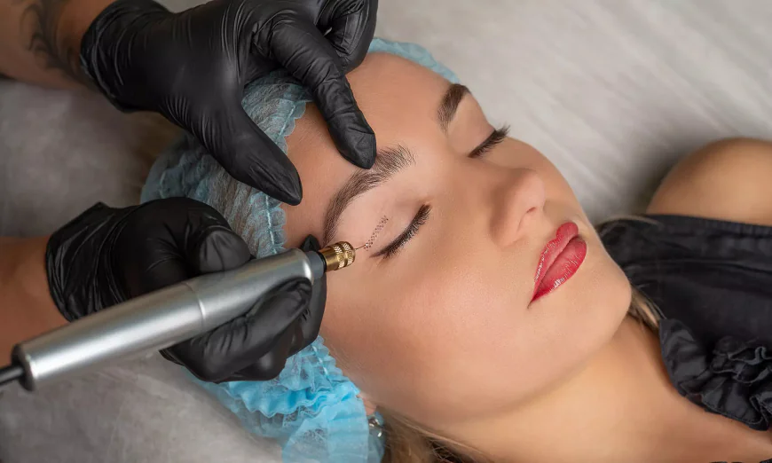 Why Does Plasma Pen Improve Skin Texture Over Time?