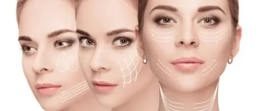 Thread Lift in Dubai: Professional Anti-Aging Treatment