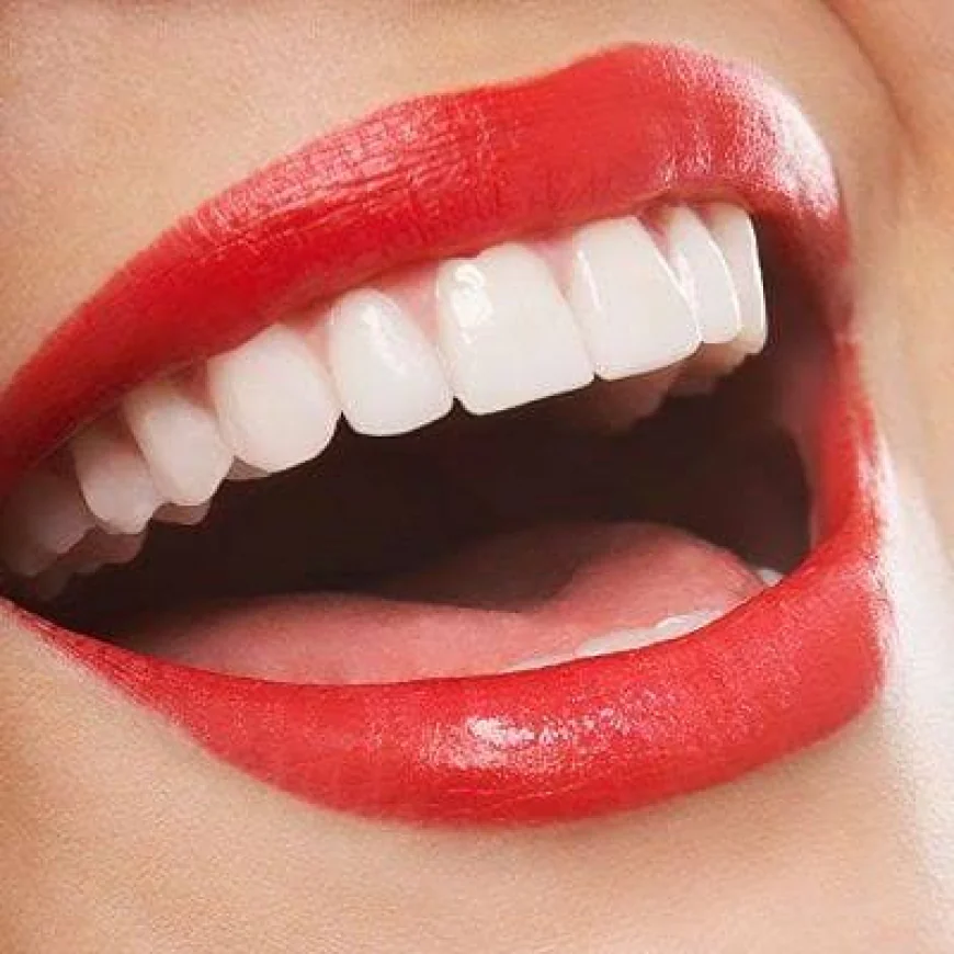 What Is the Process Behind Hollywood Smile Design?