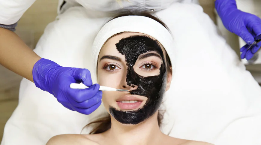 Top Benefits of the Laser Carbon Peel for Skin Rejuvenation