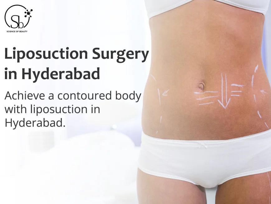 How Effective Is Liposuction in Managing Thigh Chafing