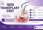 Teeth Transplant Cost: 7 Things You Should Know Before Getting Dental Implants