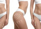 Body Contouring in Islamabad: How Proportion Creates the Perfect Visual Balance