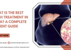 What Is the Best NASH Treatment in India? A Complete Patient Guide