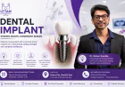 Dental Implant: What to Expect Before, During, and After the Procedure