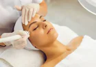 How Effective Is Radio Frequency For Acne Scars?