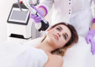 Does Laser Skin Resurfacing Improve Large Pores?