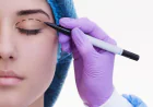 Blepharoplasty in Dubai: Restore Youthful Eyes Naturally