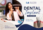Are Dental Implants a Good Option for Replacing Missing Teeth?