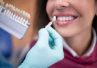 Teeth Whitening in Dubai: What to Expect