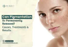 Can Pigmentation Be Permanently Removed? Causes, Treatments & Results