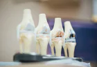 Knee Implants Market Size, Trends, and Strategic Outlook 2026-2033