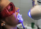 Achieve a Radiant Smile with Philips Zoom Whitening Mount Roskill, Auckland