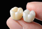 Dental Crowns in Restorative Dentistry Enhance Your Smile and Confidence