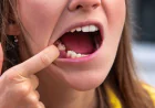 Effective Solutions for Missing Teeth Restoration