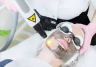 Can Laser Carbon Peel refresh tired-looking skin
